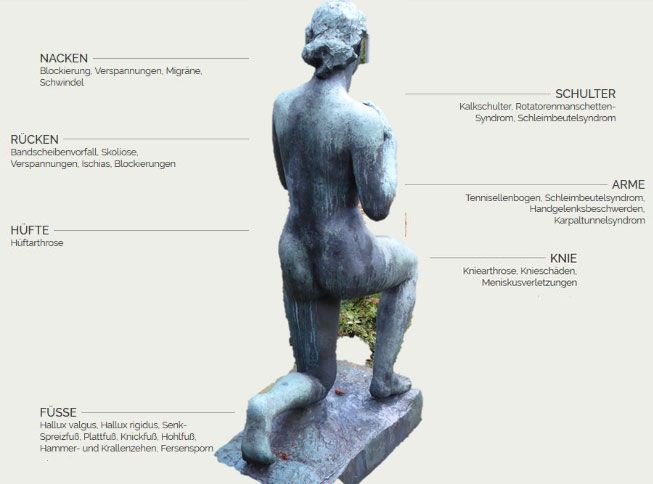 Schaubild der Schwerpunkte unserer Praxis. In der Mitte ist eine freigestellte Skulptur einer knieenden Frau. Den Körperteilen sind die unterschiedlichen Schwerpunkte zugeordnet.